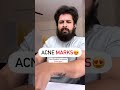Acne Marks? #shortsfeed #reels #shortsvideo #drniranjansamani #reelitfeelit #trending #viral #fyp