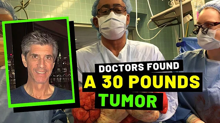 DOCTORS FOUND A 30 POUNDS TUMOR (THE KEVIN DALY CA...