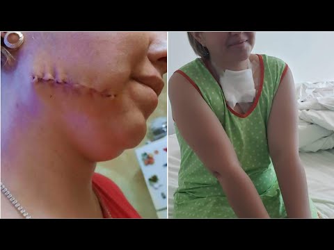 დავეხმაროთ 3 შვილის დედას მას 400 ლარი აკლდება ექიმთან მისასვლელად