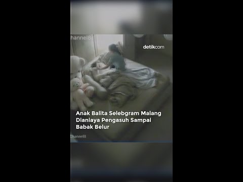 Anak Selebgram Disiksa Pengasuhanya Sampai Babak Belur