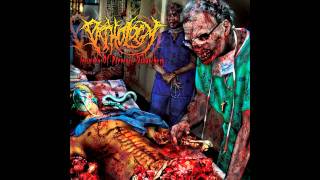 pathology - eviscerated human torso [HD]