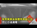 陸男駕車後身體焦黑腦出血 控比亞迪漏電｜TVBS新聞 @TVBSNEWS02