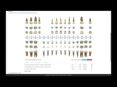 Vídeo de demostración: El odontograma digital en XDentalCloud
