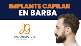 Implante Capilar FUE EN BARBA  técnica a 6 manos (Dr Julio Gil Bogotá 2022)