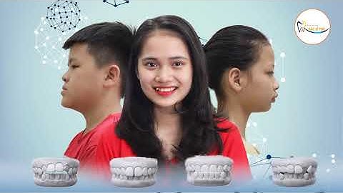 TẠM BIỆT RĂNG HÔ, THƯA, MÓM , KHẤP KHỂNH KHI NIỀNG RĂNG TẠI NK BÁC SĨ THU