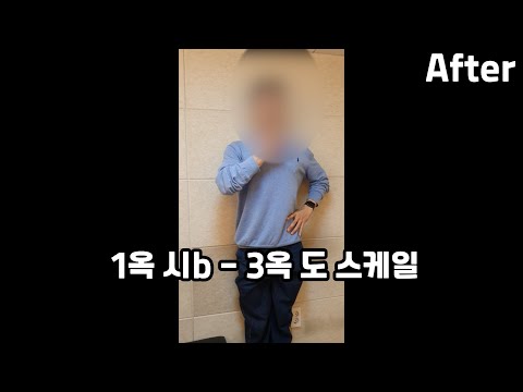 바리톤은 정말 고음이 불가능할까? -  비포&에프터 (3옥타브 도)