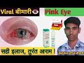 EYE FLU से बचाव ! Eye Flu Prevention! Best Medicine  Instant Relief 2023