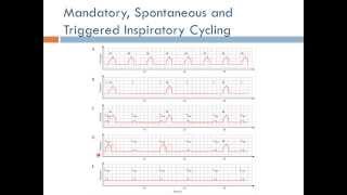 Medical Equipment: Mechanical Ventilator (Arabic Narration)