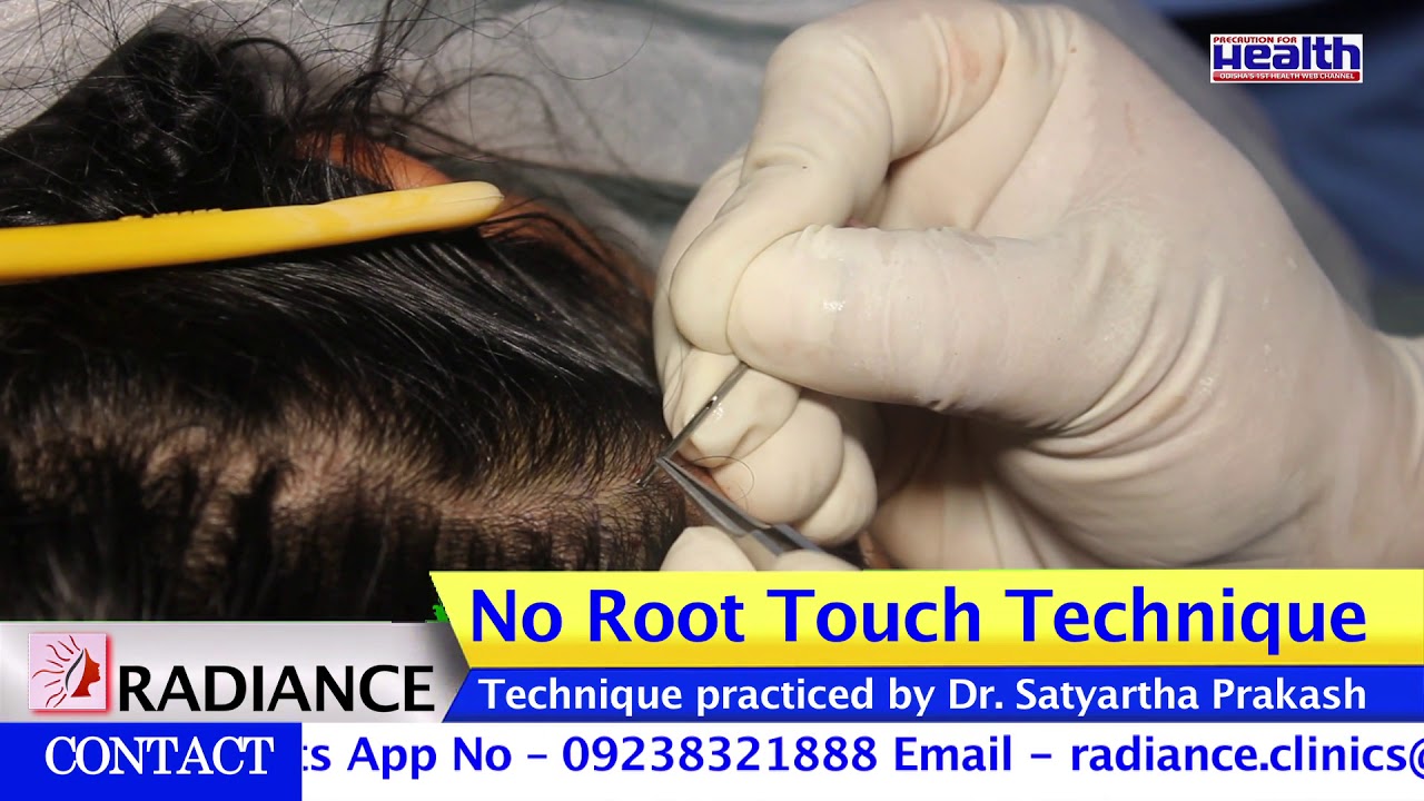 Best Hair Transplant Clinic In India  Hair Transplant Cost