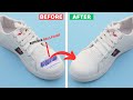 How to remove ball pen ink stain from white shoes  house keeper