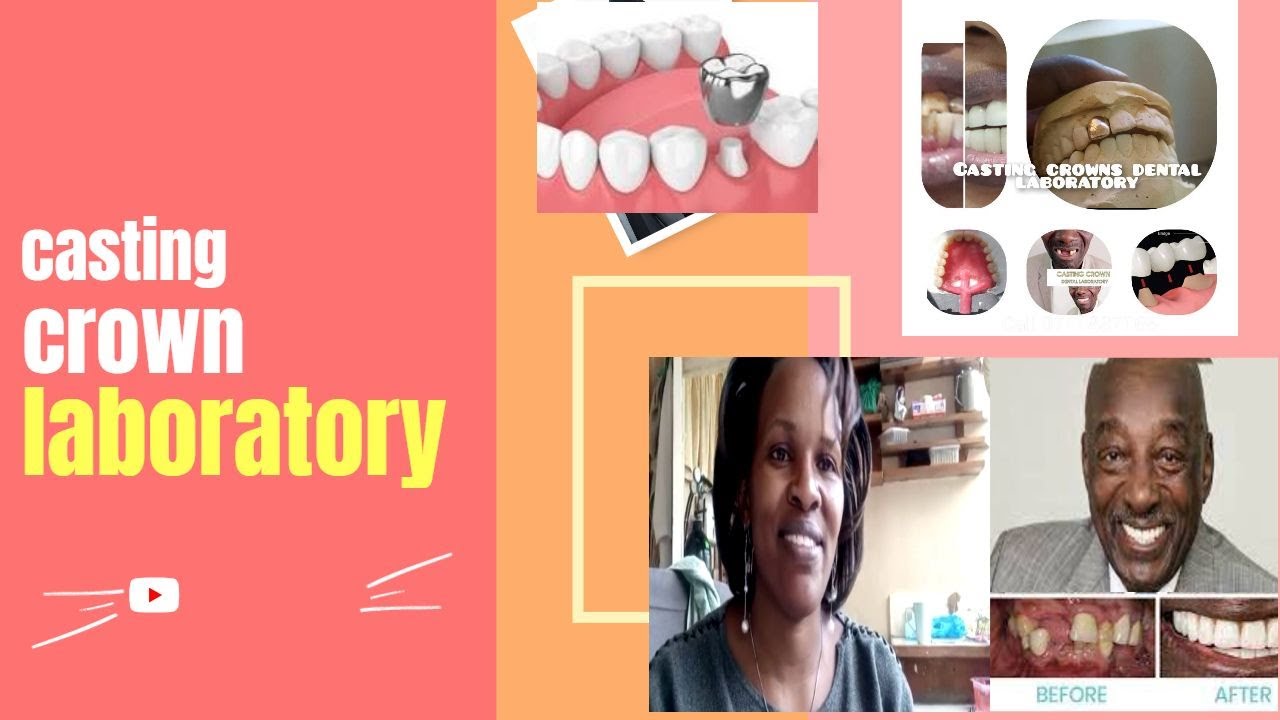 casting crown laboratory YouTube
