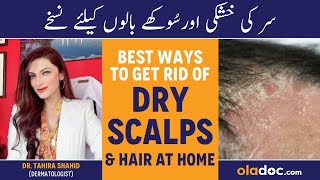 Treat Dry Scalp At Home - How To Avoid Dry Scalp & Hair Loss - Sar Aur Baalo Ki Khushki Ka Ilaj