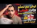 5 عادات يومية تدمر شعرك وتسبب الصلع المبكر توقف عنها فورا