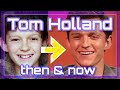 Tom Holland teeth now and then Part1!! BEFORE &amp; AFTER of MARVEL SPIDERMAN: Hollywood braces surgery