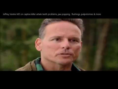 Jeffrey Ventre MD on Captive Killer Whale Teeth Damage, Jaw popping, & Pulpotomies