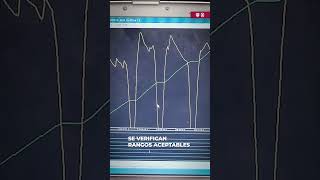 Cada Que Un Tren Entra A Mantenimiento Se Revisa El Software Registrador De Eventos