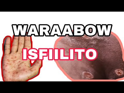 WARAABOW/ISFIILITO(syphills)||SABABHA CALAAMADAHA KA HOR TAGA DAAWADA