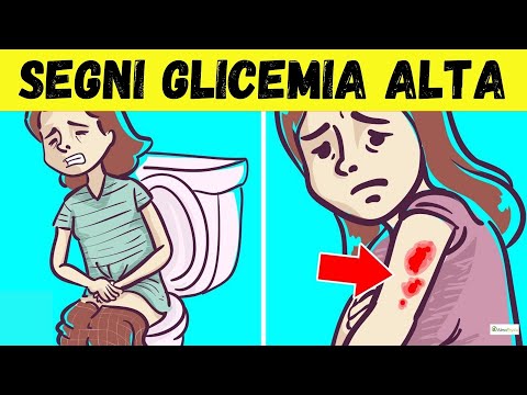 Video: Come regolare la posizione della sedia da ufficio (con immagini)