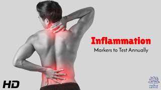 Inflammation Markers You Need to Track Yearly to Avoid Hidden Health Risks