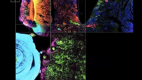 How To... align huge microscopy images with Big Stitcher