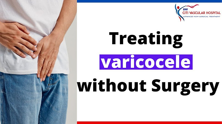 Varicocele Treatment | Treating Varicocele Without Surgery in Hyderabad