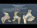 Анатомия тазобедренного сустава: строение, классификация, вспомогательный аппарат, движения