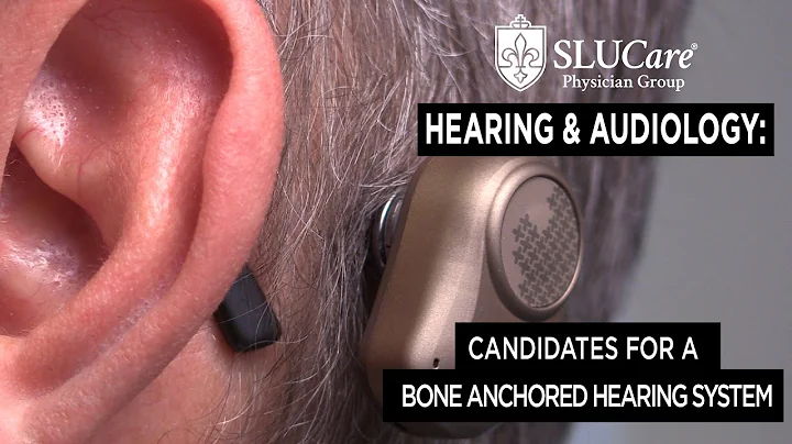 Who is right for a Bone Anchored Hearing System? -...