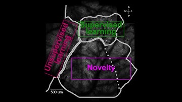 Plasticity in the visual cortex after supervised and unsupervised training