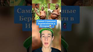 Самые Странные Беременности В Истории!😳 #Shorts #Мама #Дети #Беременность