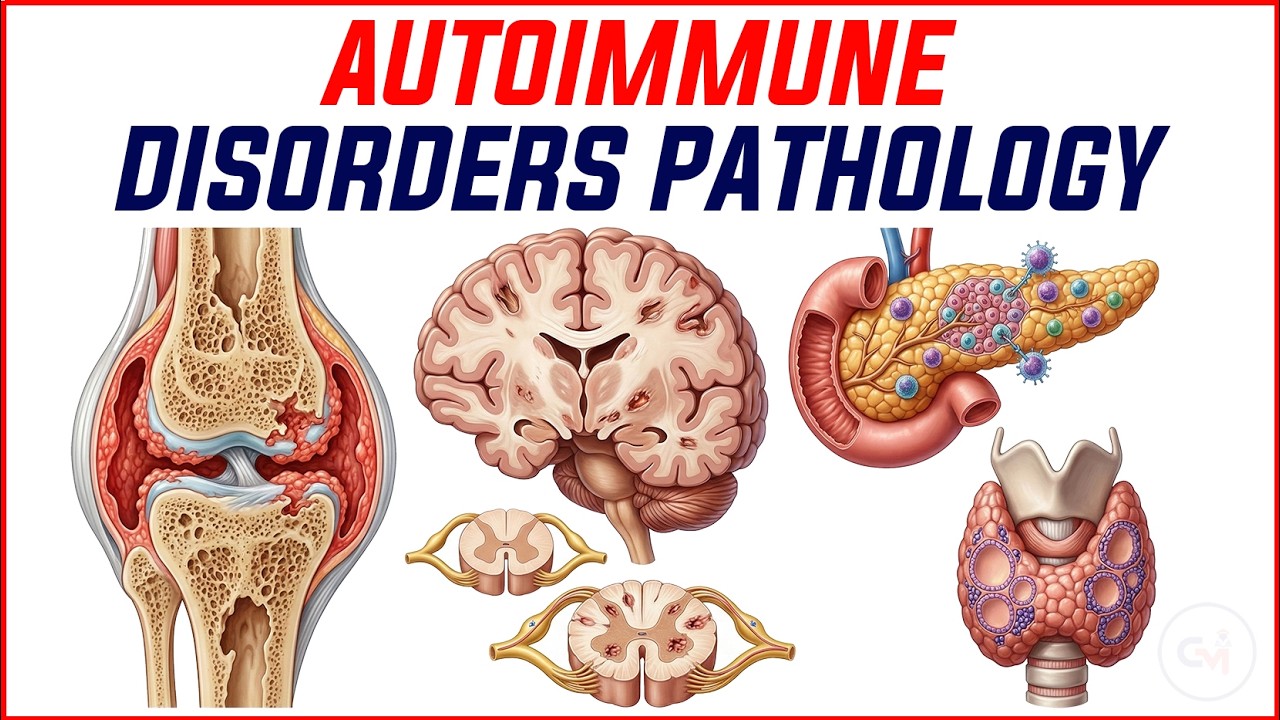 Autoimmune Disorders Pathology: SLE, RA, & The Endocrine Shield | Master the Boards 🩺