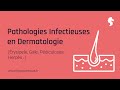 Masterclass de dermatologie sur linfectiologie cutane prsente par laura et alexandre