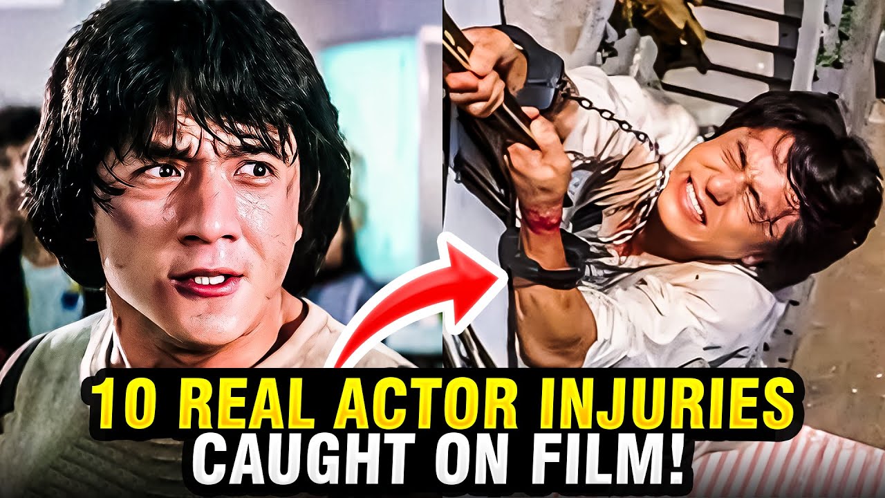 "Top 10 Shocking Actor Injuries You Won't Believe Happened on Set