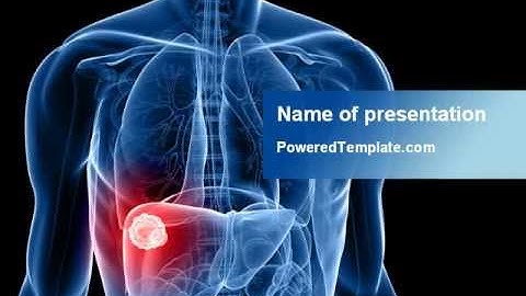 Liver Disease PowerPoint Template by PoweredTemplate.com