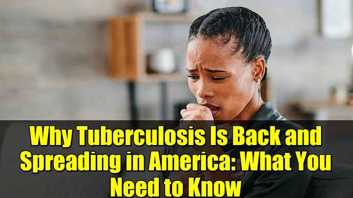 Why Tuberculosis Is Back and Spreading in America: What You Need to Know