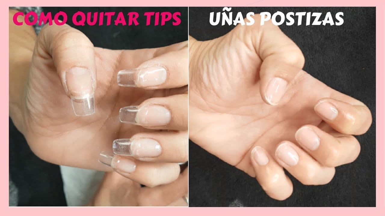 Detalle 13+ imagen como quitar uñas acrilicas con tip