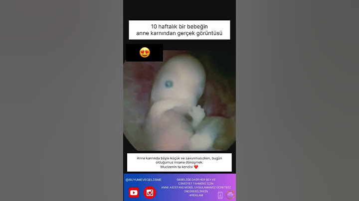 10 haftalık hamilelikte bir bebeğin anne karnından gerçek görüntüsü 😦😍
