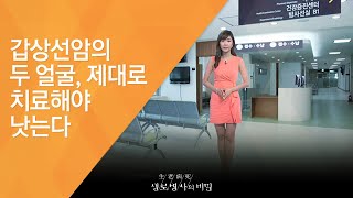 갑상선암의 두 얼굴, 제대로 치료해야 낫는다 - (20120901_425회 방송)_갑상선암의 습격