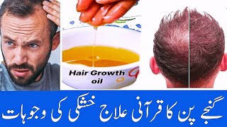 GanjaPan Ka Noorni Ilaj | How To REGROW Hair | Girte Hairs Desi Or Quranic Wazifa DUA, GanjaPan Waja