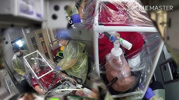 COVID-19 Inutbation with CPAP Pre-Ox