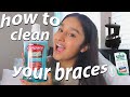 How to Clean your Braces!! | Braces Care & Experience