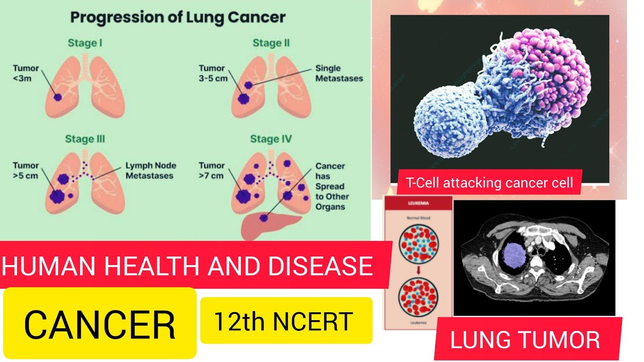 COMPLETE EXPLANATION OF CANCER ☝️ ll 12th Biology.ll - YouTube