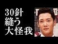 チェ・ジニョク“30針縫う大怪我「皇后の品格」制作発表会に絆創膏で登場