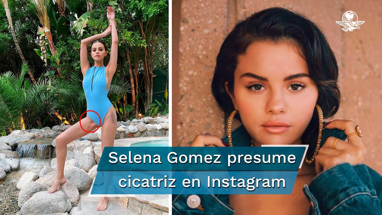 Selena Gomez Muestra Orgullosa La Cicatriz De Su Trasplante De Riñón
