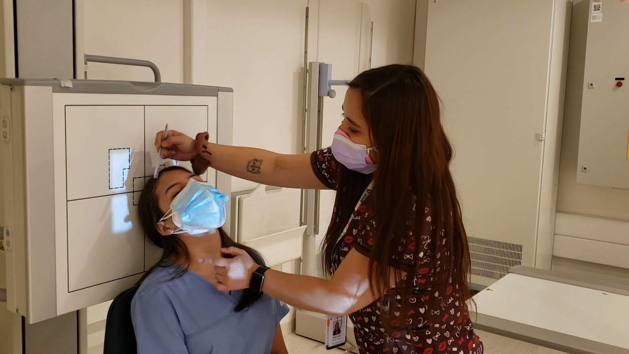 Posicionamiento Arco Cigomático Focalizado o Unilateral