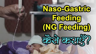 नवजत शश क Tube Feeding कस करए How To Insert Ng Tube Naso-Gastric Feeding