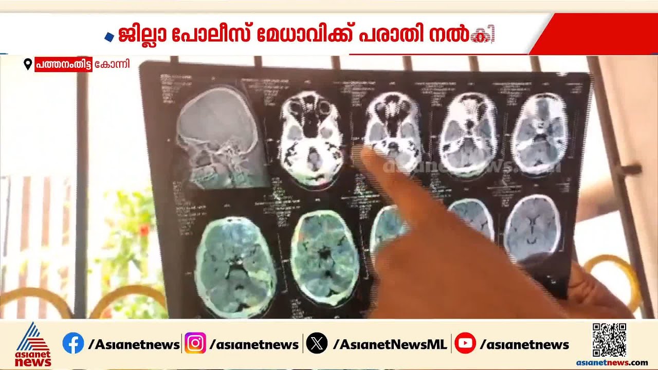 എസ്എഫ്ഐ നേതാവിനെ മറ്റൊരു എസ്എഫ്ഐ നേതാവും സംഘവും റാഗ് ചെയ്‌തെന്ന് പരാതി | Ragging