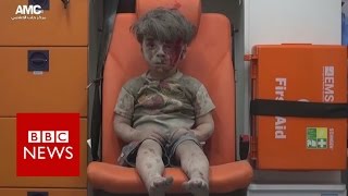 Human face of war: Aleppo boy image draws outrage - BBC News
