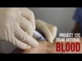 Draw Arterial Blood from the Radial Artery