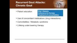 Managing Acute and Chronic Gout  From Simple to Complex
