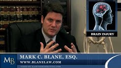 San Diego Brain Injury Lawyer, Head Trauma Attorney - Win Your Brain Injury/Trauma Case Video.mov